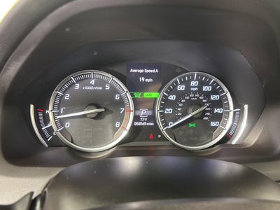 2017 Acura TLX SH-AWD/Technology Pkg